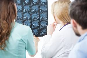 doctors reviewing mris of brain