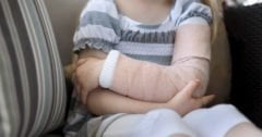 girl holding broken arm
