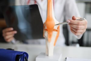 doctor reviewing x-ray and model of knee