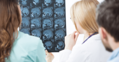 doctors reviewing mris of brain