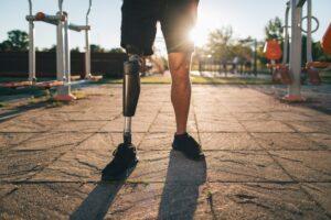 Are Amputations Covered by Workers’ Compensation?